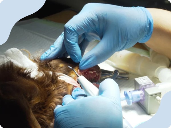 Odstraňovanie zubného kameňa